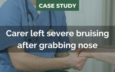 Carer dismissed after service user had unexplained bruising on nose